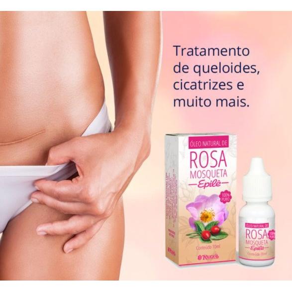 Óleo Natural Rosa Mosqueta Original Epilê 100 Puro 10ml Rugol - 1 Unidade
