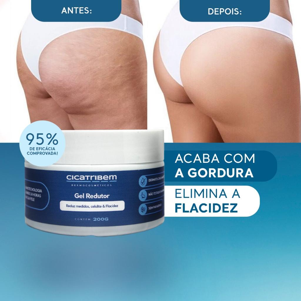 Gel Redutor De Medidas Queima De Gordura Localizada Acaba Com A Celulite 200g Cicatribem