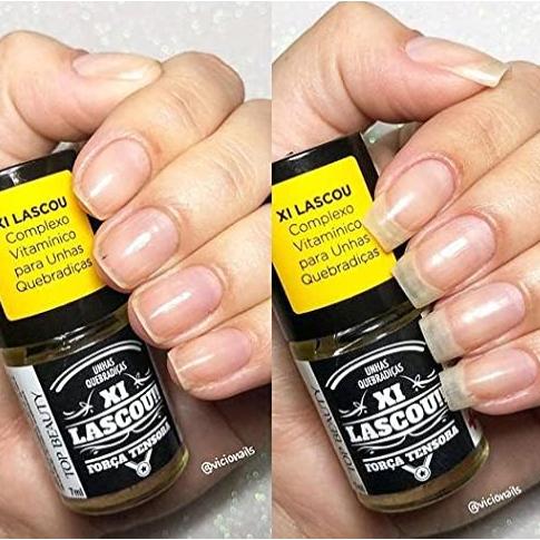 Esmalte Tratamento Top Beauty Sos Unhas Xi Lascou 7ml
