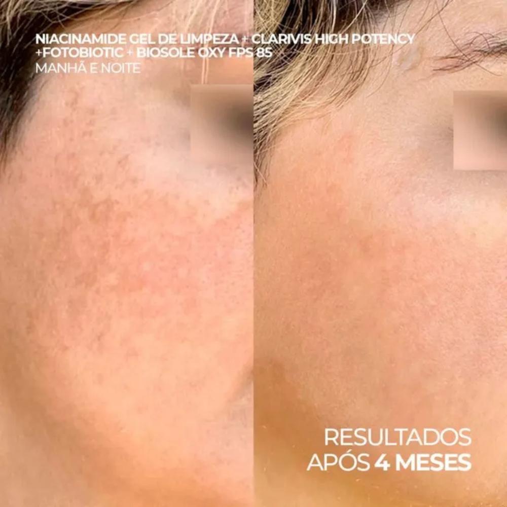 Protetor Solar Ada Tina Clareador Manchas Biosole Oxy FPS 85