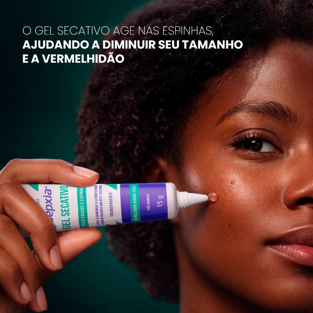 Gel Secativo Asepxia Antiacne 15g - Seca Cravos E Espinhas