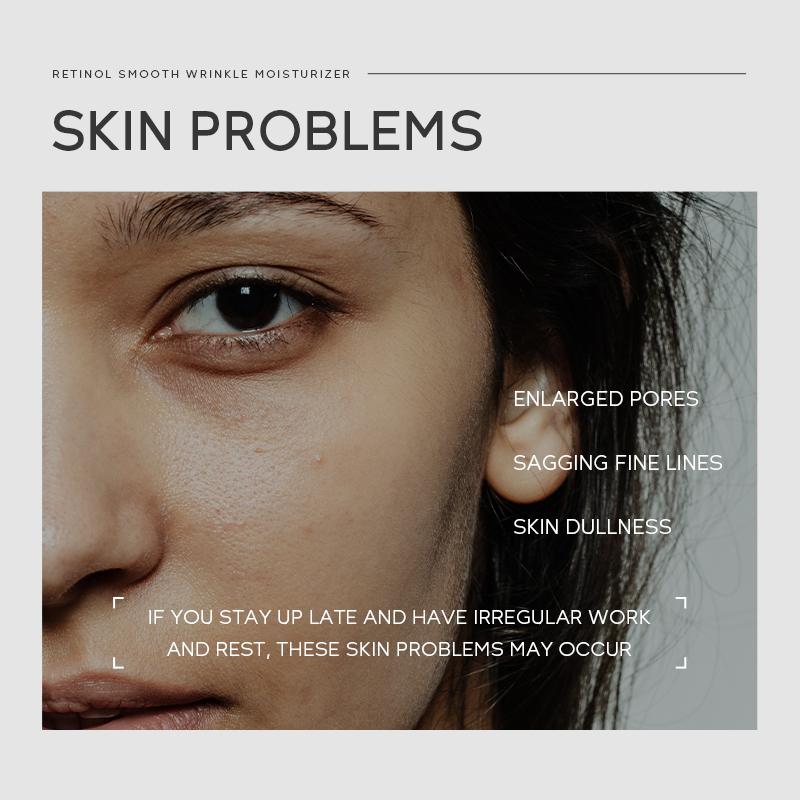 Quiyum Retinol Hidratante Suave Rugas Suaves Apertar A Pele Hidratação Profunda 30g