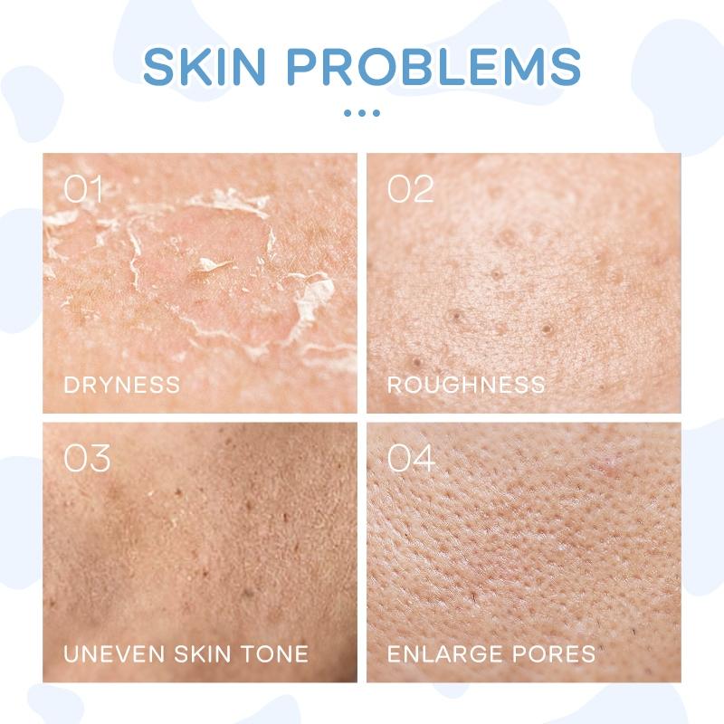 Laikou Milk Skincare Set 5pcs Com Protetor Solar Fps50 Hidratante Brilhante Suavizante Pele