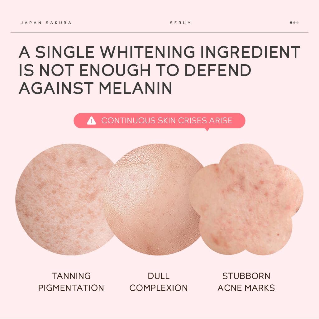 Laikou Sakura Niacinamide Skincare Set 3X Brightening Skin Tone Smooth Fine Lines Apertar Os Poros Presente Aniversário