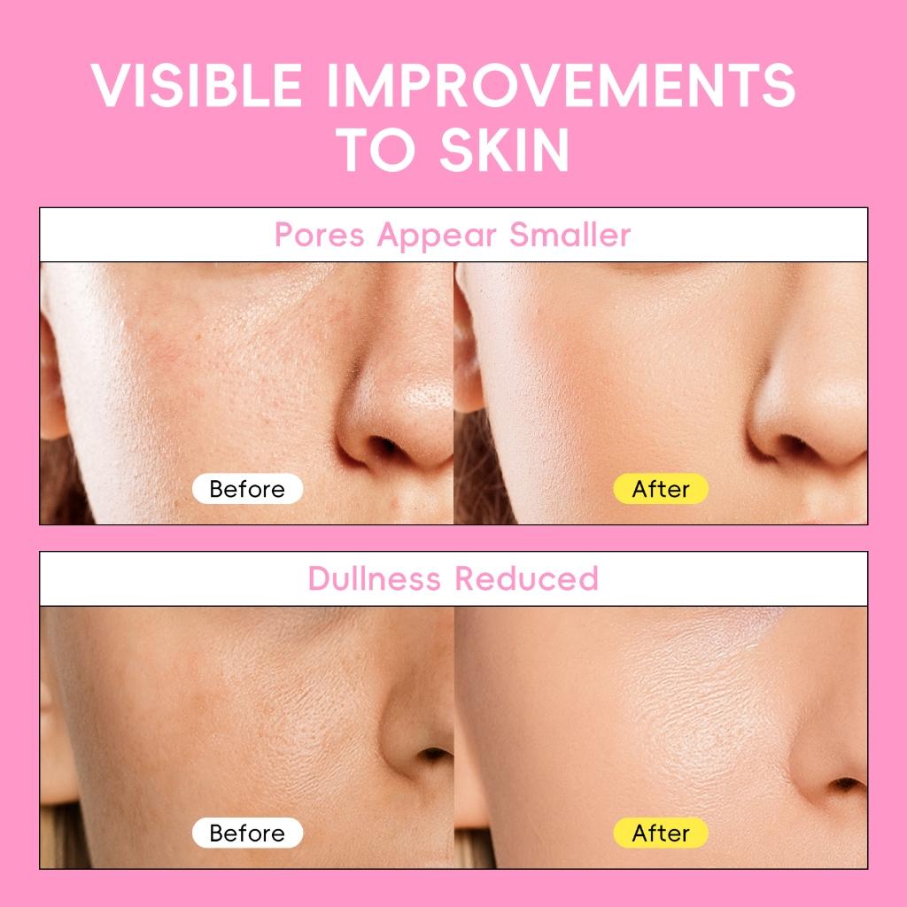 Laikou 5 Em 1 Glow Up Skincare Set Cuidados Com A Pele Radiante Fórmula Macia E Sem Fragrância