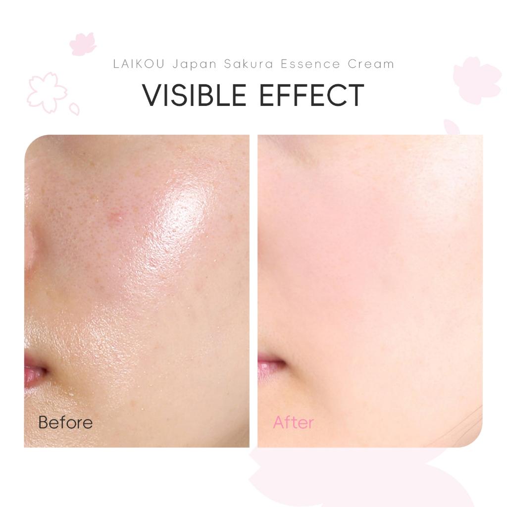 Laikou Sakura Creme Facial 50g/redutor Para Hidratação De Poros E/firmeza A Pele