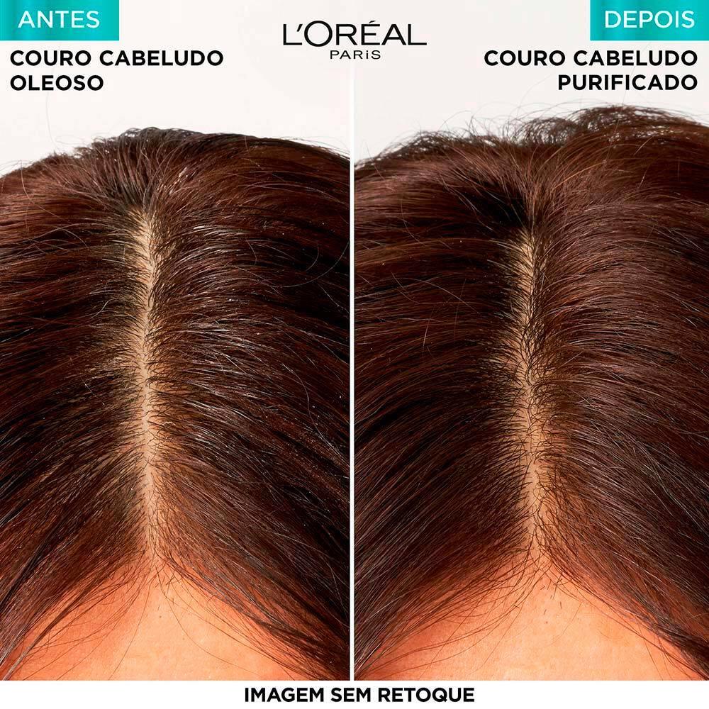 Kit Elseve Pure Hialurônico Loréal Paris Sh + Cond 200ml