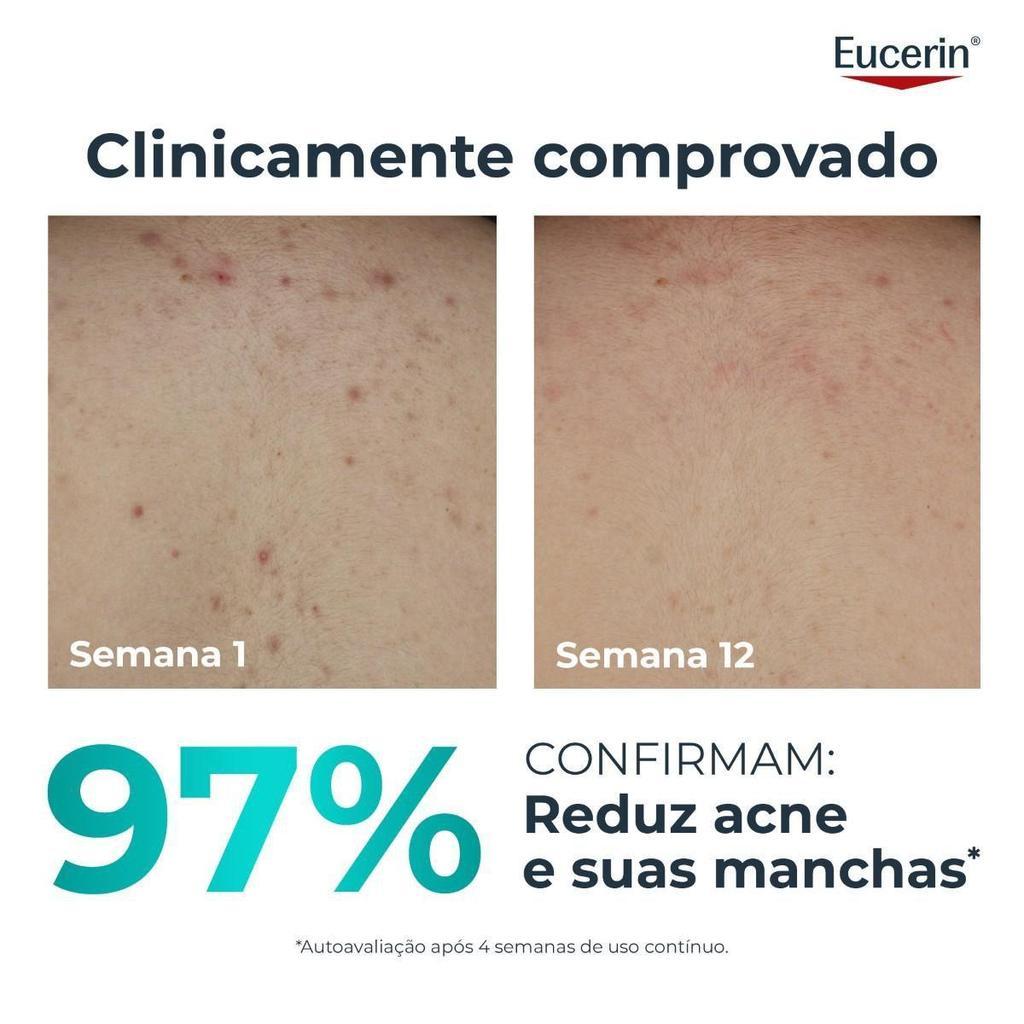 Creme Corporal Eucerin Dermopure Oil Control Efeito Triplo 200ml