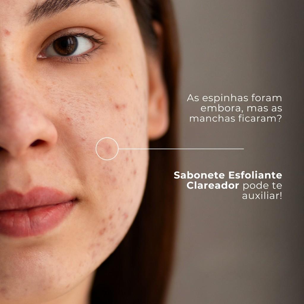 Sabonete Esfoliante Clareador Axila Dermo Skin Labotrat 80ml