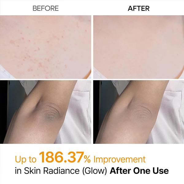 Dr.melaxin Kojic Acid Turmeric Body Peel Shot Spray 200ml