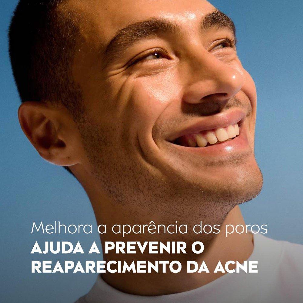 Sabonete Facial Em Gel Nivea Acne Control Limpeza Profunda Dos Poros 150g