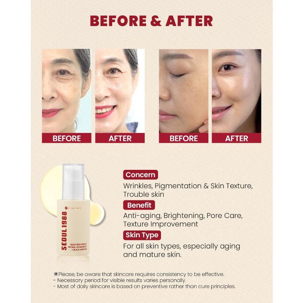K-secret Seoul 1988 Serum Retinal Liposome 2 + Black Ginseng 30ml