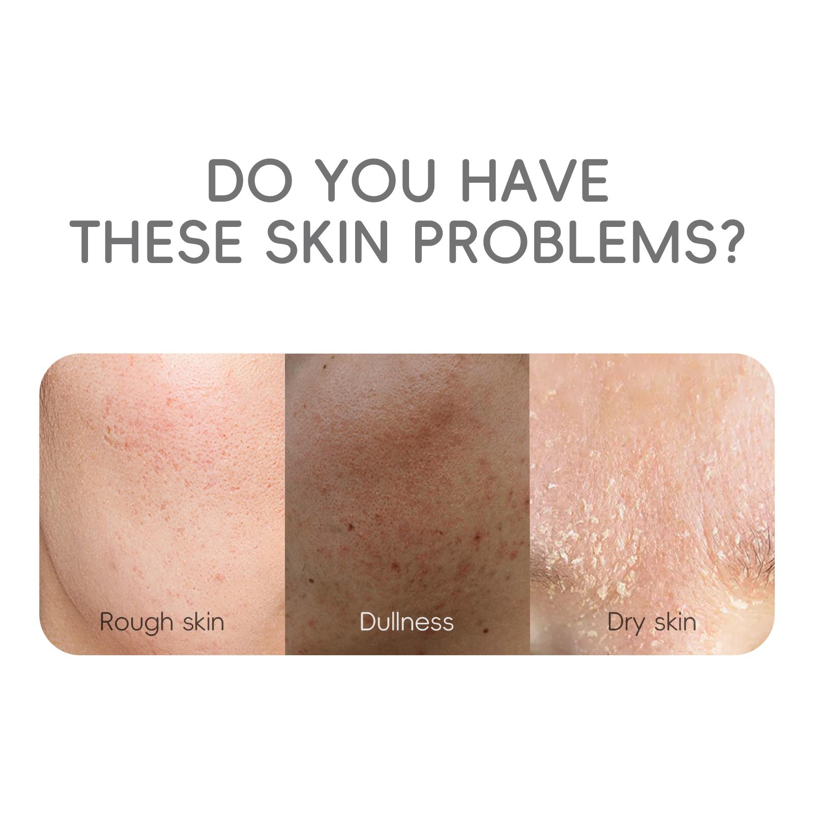 Laikou Japão Sakura Essência Creme Clareador Hidratante Reduz Anti-idade 30g
