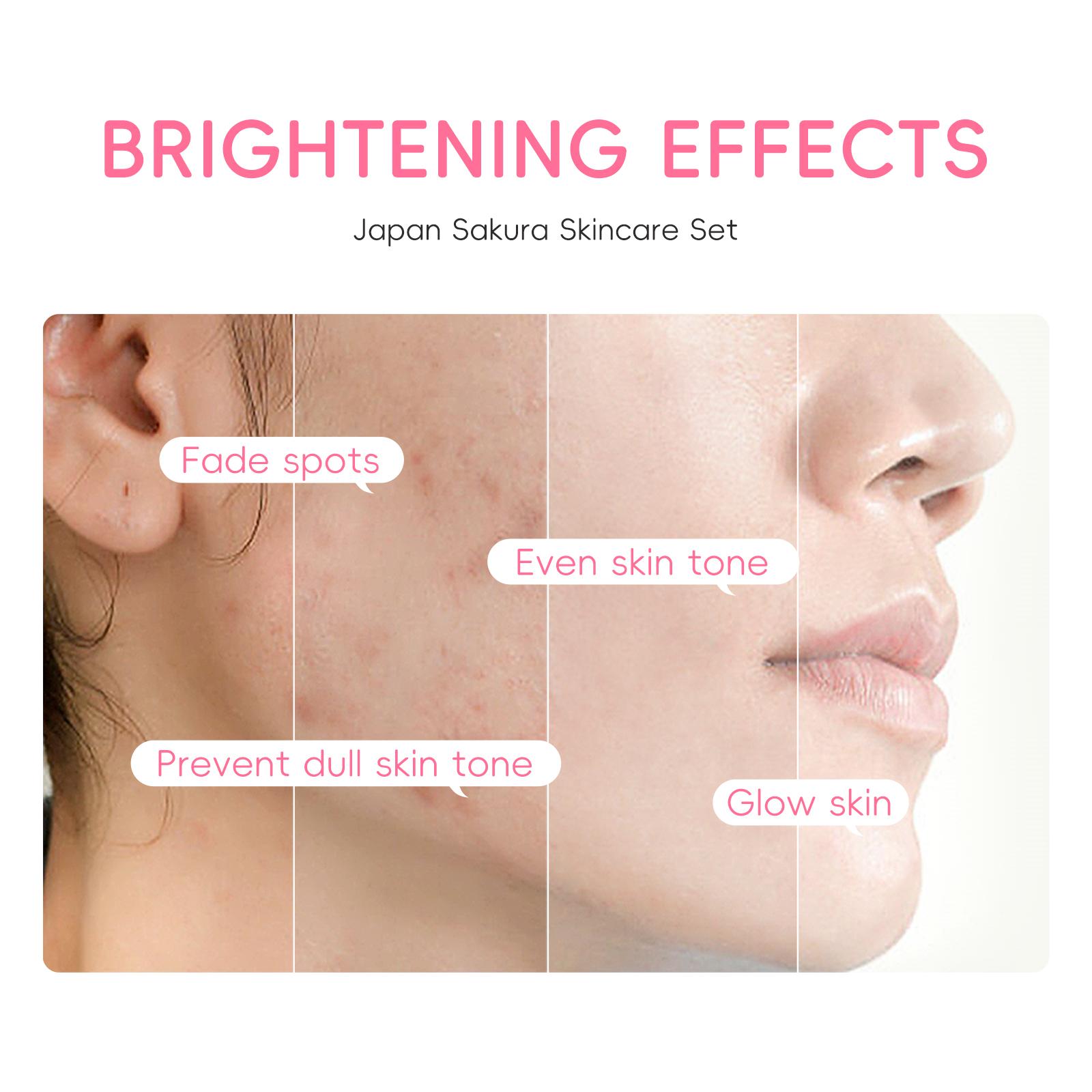 Laikou Sakura Facial Para Cuidados Com A Pele Clareador De Manchas Creme Para Apertar Poros Hidratante 3 Peças